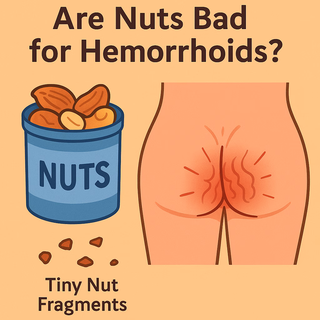 Are Nuts Bad For Hemorrhoids